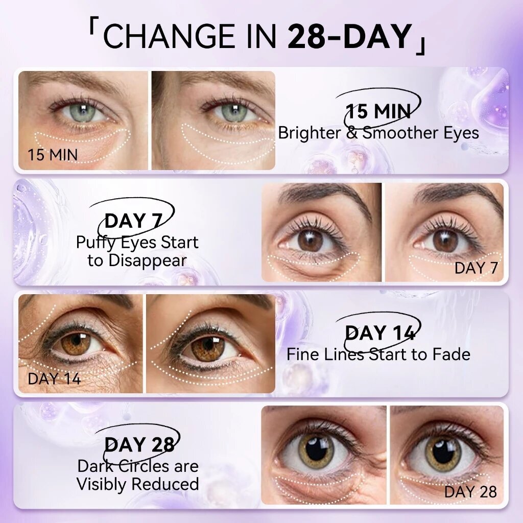 Lanbena retinol anti-rugas más - Microneedle Patch Eye avaliação e preço