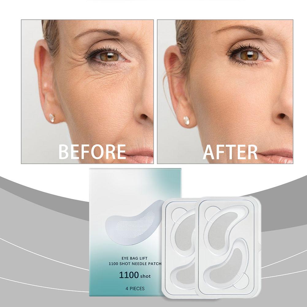 Ácido hialurônico microagulha  - Microneedle Patch Eye avaliação e preço